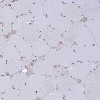 Immunohistochemistry-Paraffin: EXOSC3 Antibody [NBP1-91874] - Staining of human skeletal muscle shows very weak positivity in myocytes as expected.