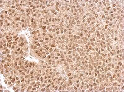 Immunohistochemistry-Paraffin: EXOSC3 Antibody [NBP2-16392] - HeLa xenograft. EXOSC3 antibody dilution: 1:500. Antigen Retrieval: Trilogy™ (EDTA based, pH 8.0) buffer, 15min