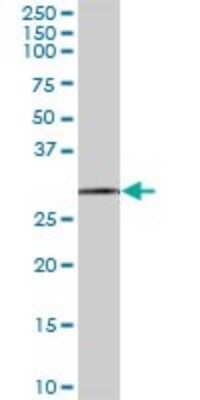 Western Blot: EXOSC3 Antibody [H00051010-B01P] - Analysis of EXOSC3 expression in human pancreas.