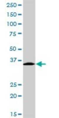 Western Blot: EXOSC3 Antibody [H00051010-D01P] - Analysis of EXOSC3 expression in human spleen.