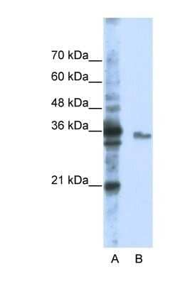 Western Blot: EXOSC3 Antibody [NBP1-57209] - Jurkat cell lysate, Antibody Titration: 0.2-1 ug/ml