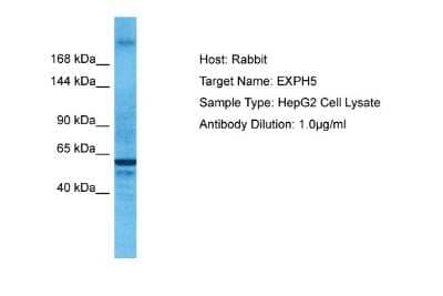 Western Blot: EXPH5 Antibody [NBP1-80506] - Host: Rabbit. Target Name: EXPH5. Sample Tissue: Human HepG2 Whole Cell. Antibody Dilution: 1ug/ml