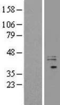 Western Blot: EXTL2 Overexpression Lysate (Adult Normal) [NBL1-10394] Left-Empty vector transfected control cell lysate (HEK293 cell lysate); Right -Over-expression Lysate for EXTL2.