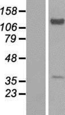 Western Blot: EXTL2 Overexpression Lysate (Adult Normal) [NBP2-08620] Left-Empty vector transfected control cell lysate (HEK293 cell lysate); Right -Over-expression Lysate for EXTL2.