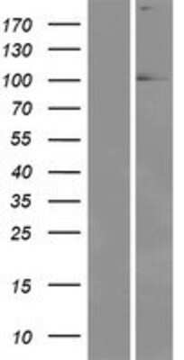 Western Blot: EYA1 Overexpression Lysate (Adult Normal) [NBP2-05188] Left-Empty vector transfected control cell lysate (HEK293 cell lysate); Right -Over-expression Lysate for EYA1.