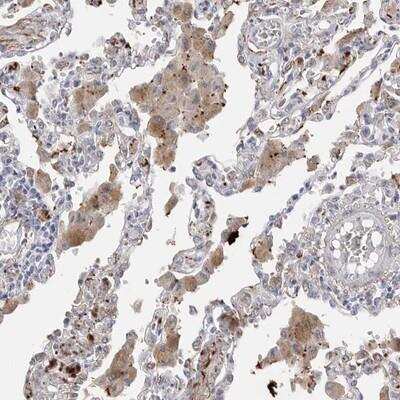 Immunohistochemistry-Paraffin: EYS/RP25 Antibody [NBP1-90038] - Staining of human lung shows moderate cytoplasmic positivity in lung macrophages.