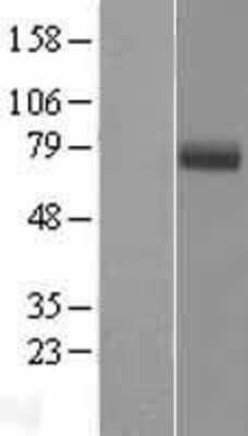 Western Blot EYS/RP25 Overexpression Lysate