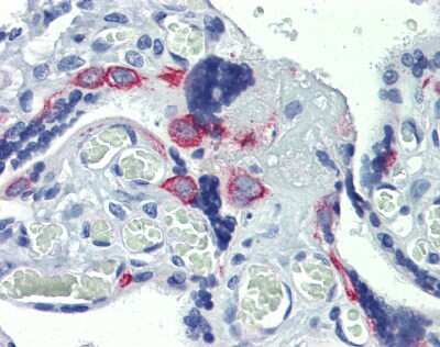 Immunohistochemistry EZFIT/ZNF71 Antibody - BSA Free