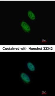 Immunocytochemistry/Immunofluorescence: EZH1 Antibody [NBP1-32111] - Paraformaldehyde-fixed HeLa, using EZH1 antibody at 1:1000 dilution.