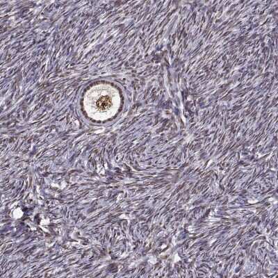 Immunohistochemistry: EZH1 Antibody [NBP2-69048] - Immunohistochemical staining of human ovary shows moderate nuclear positivity in follicle cells.