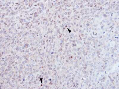 Immunohistochemistry-Paraffin: EZH1 Antibody [NBP1-32111] - H1299 xenograft, using EZH1antibody at 1:500 dilution. Antigen Retrieval: Trilogy™ (EDTA based, pH 8.0) buffer, 15min.