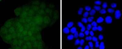 Immunocytochemistry/Immunofluorescence: EZH2/KMT6 Antibody (JJ089-9) [NBP2-67881] - Staining KMT6/EZH2 in Hela cells (green). The nuclear counter stain is DAPI (blue). Cells were fixed in paraformaldehyde, permeabilised with 0.25% Triton X100/PBS.