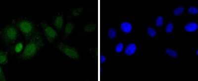 Immunocytochemistry/Immunofluorescence: EZH2/KMT6 Antibody (JJ089-9) [NBP2-67881] - Staining KMT6/EZH2 in HepG2 cells (green). The nuclear counter stain is DAPI (blue). Cells were fixed in paraformaldehyde, permeabilised with 0.25% Triton X100/PBS.