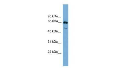 Western Blot: Ebf4 Antibody [NBP2-84015] - WB Suggested Anti-Ebf4 Antibody Titration: 0.2-1 ug/ml. ELISA Titer: 1:1562500. Positive Control: SP2/0 cell lysate