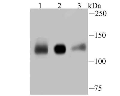Western Blot: Eg5 Antibody (JU83-16) [NBP2-75479] - Analysis of Eg5 on different cell lysates using anti-Eg5 antibody at 1/500 dilution. Positive control: Lane 1: 293, Lane 2: A431, Lane 3: Jurkat.