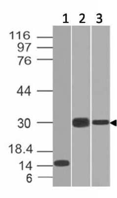 Western Blot: Elastase Antibody (CELA3B/1218) [NBP2-44812] - Western Blot of Recombinant, Panc-28 and PANC1 cell lysates using Elastase Antibody (CELA3B/1218).