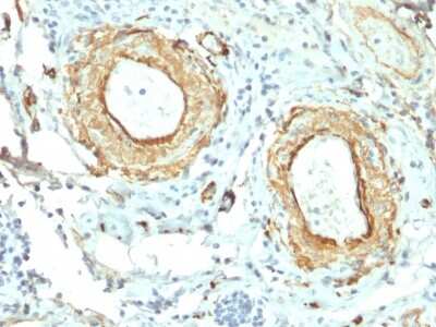 Immunohistochemistry-Paraffin: Elastin Antibody (ELN/2069) - Azide and BSA Free [NBP3-08889] - Formalin-fixed, paraffin-embedded human Small Intestine stained with Elastin Mouse Monoclonal Antibody (ELN/2069).