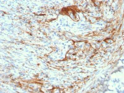 Immunohistochemistry-Paraffin: Elastin Antibody (ELN/3131R) - Azide and BSA Free [NBP3-08890] - Formalin-fixed, paraffin-embedded human Small Intestine stained with Rabbit Recombinant Monoclonal Antibody (ELN/3131R) to Elastin.