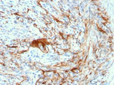 Immunohistochemistry-Paraffin: Elastin Antibody (ELN/3131R) - Azide and BSA Free [NBP3-08890] - Formalin-fixed, paraffin-embedded human Small Intestine stained with Elastin antibody (ELN/3131R).