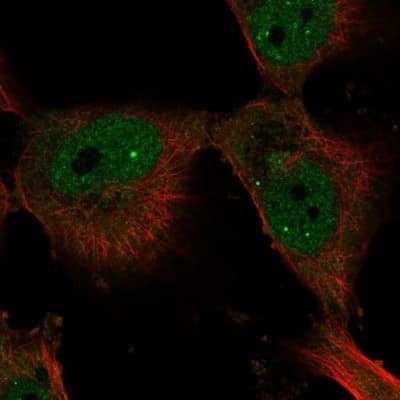 Immunocytochemistry/Immunofluorescence: Elf4/MEF Antibody [NBP2-56927] - Staining of human cell line U-251 MG shows localization to nuclear bodies.