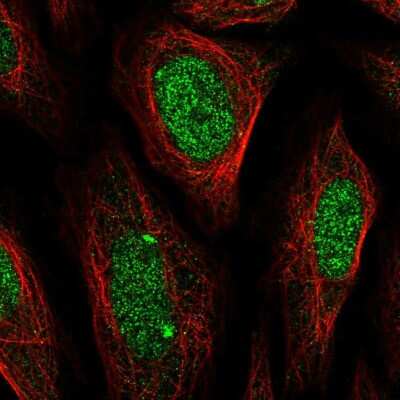 Immunocytochemistry/Immunofluorescence: Elk-1 Antibody [NBP2-57053] - Staining of human cell line SiHa shows localization to nucleoplasm.