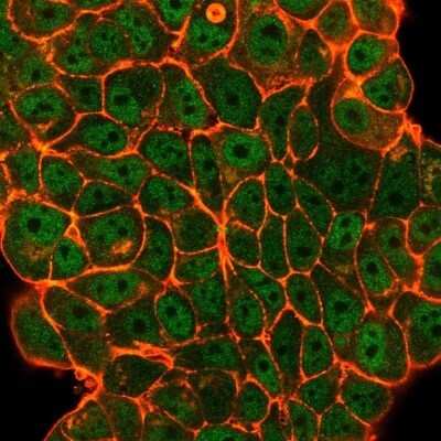 Immunocytochemistry/Immunofluorescence: Elk-1 Antibody (PCRP-ELK1-1D9) [NBP3-08888] - Immunofluorescent analysis of PFA-fixed MCF-7 cells. Elk-1 Mouse Monoclonal Antibody (PCRP-Elk-1-1D9) followed by goat anti- Mouse IgG-CF488 (green); counterstain is phalloidin (red).