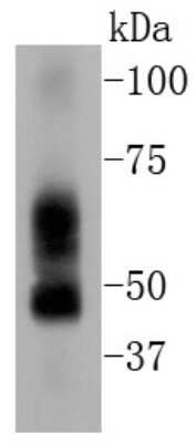 Western Blot: Elk-1 Antibody (SU32-05) [NBP2-67459] - Analysis of ELK1 on human lung lysates using anti-ELK1 antibody at 1/1,000 dilution.