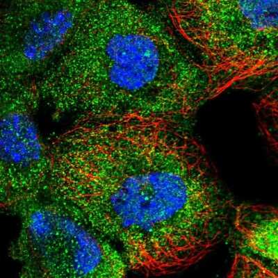 Immunocytochemistry/Immunofluorescence: Ells1 Antibody [NBP1-90477] - Staining of human cell line A-431 shows localization to cytosol. Antibody staining is shown in green.