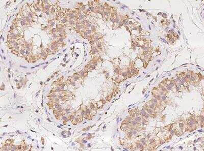 Immunohistochemistry-Paraffin: Ells1 Antibody [NBP3-05896] - Staining of human Ells1 in human testis with rabbit polyclonal antibody at 1:1000 dilution.