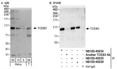 Western Blot: Elongin A Antibody [NB100-40835] - Detection of Human TCEB3 on HeLa whole cell lysate using NB100-40835. TCEB3 was also immunoprecipitated by rabbit anti-TCEB3 antibodies NB100-40834and NB100-40836.