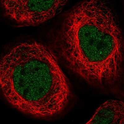 Immunocytochemistry/Immunofluorescence: Elp4 Antibody [NBP2-47473] - Staining of human cell line A-431 shows localization to nucleoplasm. Antibody staining is shown in green. 