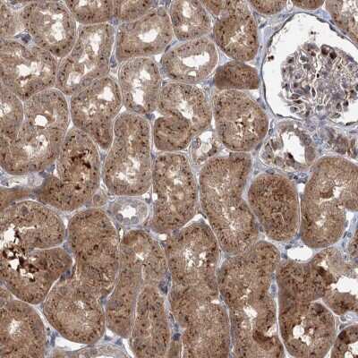 Immunohistochemistry: Elp4 Antibody [NBP2-47472] - Staining of human kidney shows cytoplasmic positivity in cells in tubules.