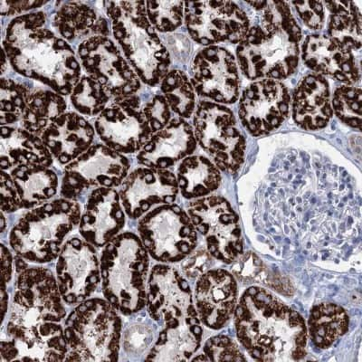 Immunohistochemistry-Paraffin: Elp4 Antibody [NBP2-47473] - Staining of human kidney shows strong granular cytoplasmic positivity in cells in tubules.