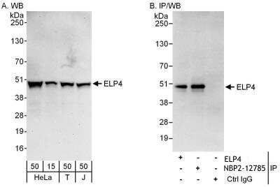 Immunoprecipitation: Elp4 Antibody [NBP2-12785] - Samples: Whole cell lysate from HeLa (15 and 50 ug for WB; 1 mg for IP, 20% of IP loaded), 293T (T; 50 ug) and Jurkat (J; 50 ug) cells. Antibodies: Affinity purified rabbit anti-ELP4 antibody NBP2-12785 used for WB at 0.1 ug/ml (A) and 1 ug/ml (B) and used for IP at 6 ug/mg lysate. ELP4 was also immunoprecipitated by rabbit anti-ELP4 antibody, which recognizes an upstream epitope. For blotting immunoprecipitated ELP4. Detection:Chemiluminescence with exposure times of 30 seconds (A) and 3 seconds (B).