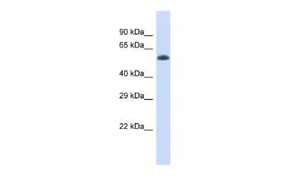 Western Blot: Elp4 Antibody [NBP3-10631] - Western blot analysis of Elp4 in Fetal Heart lysates. Antibody dilution at 1.0ug/ml