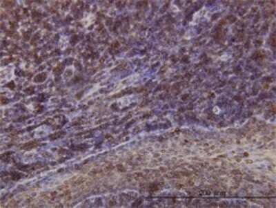 Immunohistochemistry-Paraffin: Emerin Antibody (3B9) [H00002010-M01] - Analysis of monoclonal antibody to EMD on formalin-fixed paraffin-embedded human tonsil. Antibody concentration 1 ug/ml.