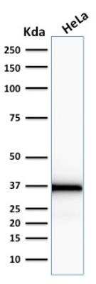 Western Blot: Emerin Antibody (EMD/2167) - Azide and BSA Free [NBP2-79918] - Western Blot Analysis of human HeLa cell lysate using Emerin Mouse Monoclonal Antibody (EMD/2167).