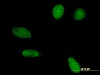 Immunocytochemistry/Immunofluorescence: Emerin Antibody [H00002010-B01P] - Analysis of purified antibody to EMD on HeLa cell. (antibody concentration 10 ug/ml)