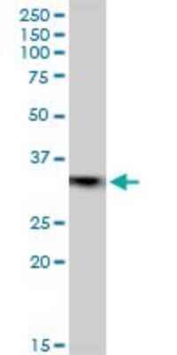 Western Blot: Emerin Antibody [H00002010-B01P] - Analysis of EMD expression in MCF-7.