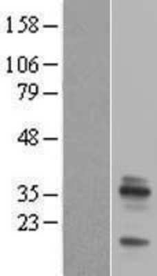 Western Blot Emerin Overexpression Lysate