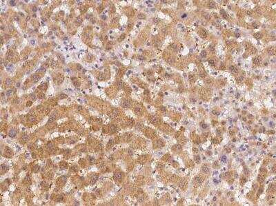 Immunohistochemistry-Paraffin: Emx1 Antibody [NBP3-12609] - Staining of human EMX1 in human liver with rabbit polyclonal antibody at 1:100 dilution.