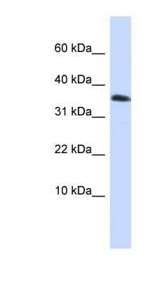 Western Blot: Emx1 Antibody [NBP1-79221] - HepG2 cell lysate, concentration 0.2-1 ug/ml.