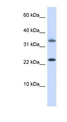 Western Blot: Emx1 Antibody [NBP1-79222] - HepG2 cell lysate, concentration 0.2-1 ug/ml.