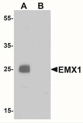 Western Blot: Emx1 Antibody [NBP2-41151] - Western blot analysis of EMX1 in rat liver tissue lysate with EMX1 antibody at 1 ug/mL in (A) the absence and (B) the presence of blocking peptide.