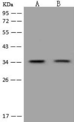 Western Blot: Emx1 Antibody [NBP3-12609] - Lane A: HepG2 Whole Cell LysateLane B: Jurkat Whole Cell LysateLysates/proteins at 30 ug per lane.SecondaryGoat Anti-Rabbit IgG (H+L)/HRP at 1/10000 dilution.Developed using the ECL technique.Performed under reducing conditions.Predicted band size:29 kDaObserved band size:35 kDa