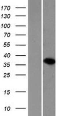 Western Blot: Emx1 Overexpression Lysate (Adult Normal) [NBP2-07912] Left-Empty vector transfected control cell lysate (HEK293 cell lysate); Right -Over-expression Lysate for Emx1.