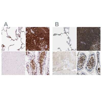 Immunohistochemistry-Paraffin: Enah/Vasp-like Antibody [NBP2-38132] - Staining of human lung, lymph node, skeletal muscle and small intestine using Anti-EVL antibody NBP2-38132 (A) shows similar protein distribution across tissues to independent antibody NBP1-80831 (B).