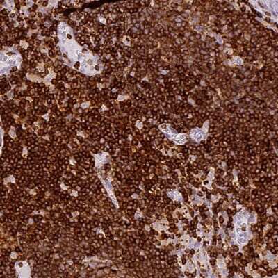 Immunohistochemistry-Paraffin: Enah/Vasp-like Antibody [NBP2-38132] - Staining of human lymph node shows moderate to strong cytoplasmic positivity in non-germinal center cells.