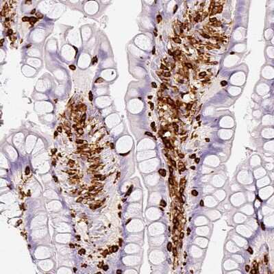 Immunohistochemistry-Paraffin: Enah/Vasp-like Antibody [NBP2-38132] - Staining of human small intestine shows moderate to strong cytoplasmic positivity in lymphoid cells.