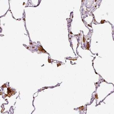 Immunohistochemistry-Paraffin: Enah/Vasp-like Antibody [NBP2-38132] - Staining of human lung shows moderate to strong cytoplasmic positivity in macrophages.